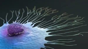ArteraAI Receives FDA Clearance for Breast Cancer Diagnostic Tool, Expanding its Multimodal AI Oncology Portfolio