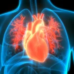 Artivion Prepares for Strategic U.S. Launch of Nexus Aortic Arch System as Competitive Landscape Shifts