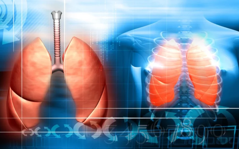 Beyond the Lab: The New Era of Respiratory Effort Monitoring in Home Sleep Testing
