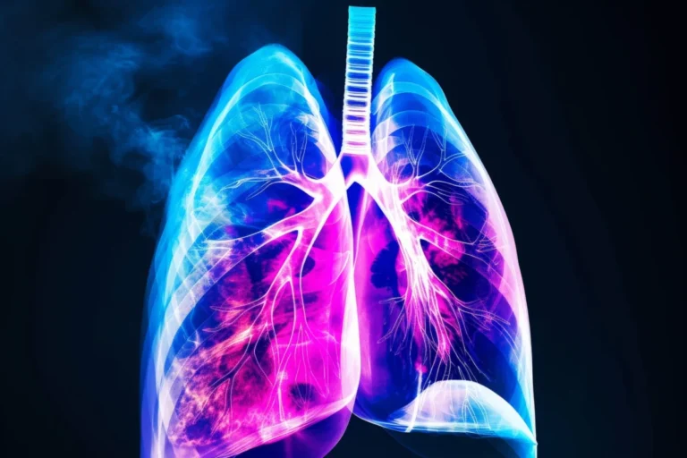 Breakthrough in Idiopathic Pulmonary Fibrosis: TETON Trials Signal New Era for Nebulized Treprostinil