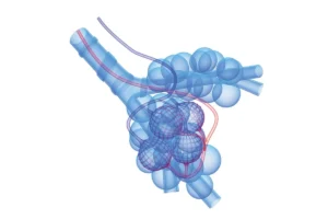 Breakthrough in Pulmonary Care: New Phase 3 Data Highlights Potential of Molgramostim for Autoimmune PAP