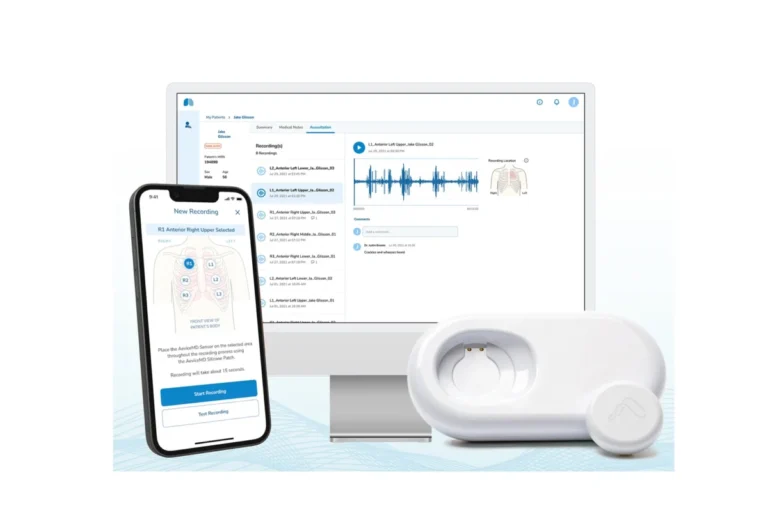 Bridging the Gap: How Wearable Tech is Transforming Pediatric Asthma Management at Cedars-Sinai