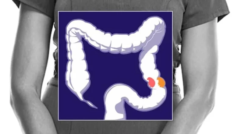 Decoding the Tumor: The Race to Revolutionize Immunotherapy for Colorectal Cancer