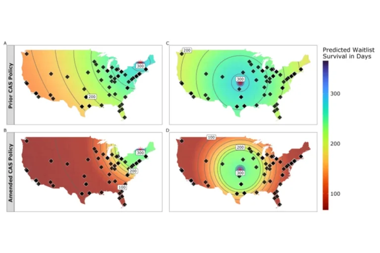 Geographic Disparity Persists: New Study Challenges Recent Lung Allocation Policies
