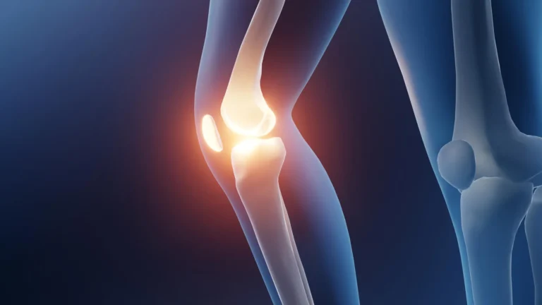 Moving Toward Mobility: New Landmark Study Identifies Aerobic Exercise as the Gold Standard for Knee Osteoarthritis