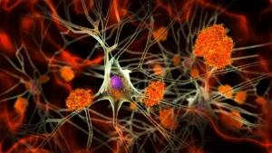 Silent Signals: New Research Reveals Alzheimer’s Pathology in Midlife Adults
