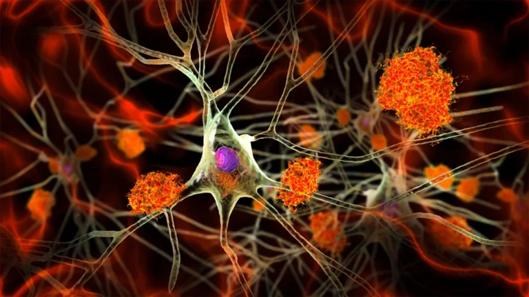 Silent Signals: New Research Reveals Alzheimer’s Pathology in Midlife Adults