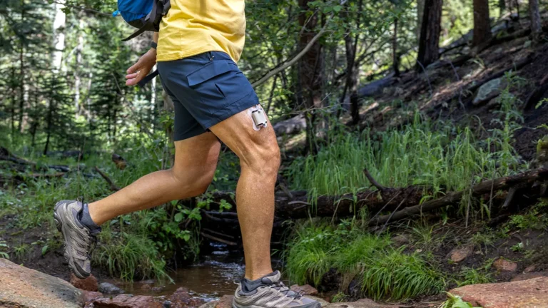Tandem Diabetes Care Pivots to Tubeless Future: A Strategic Shift in Insulin Delivery