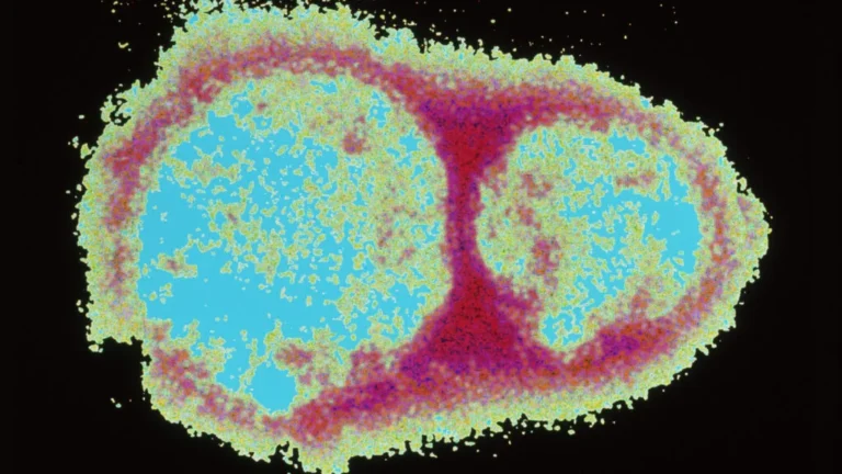The Architecture of Deceit: How the MV Hondius Hantavirus Outbreak Became a Case Study in Viral Misinformation