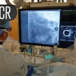 The Hidden Engine of Heart Disease: New Insights into Coronary Microvascular Dysfunction