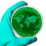The Hidden Global Tax: How Tuberculosis Erodes 0.8% of the World’s Economic Potential