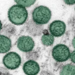 The Hidden Threat: How the Andes Hantavirus Cruise Ship Outbreak Exposed Global Health Vulnerabilities