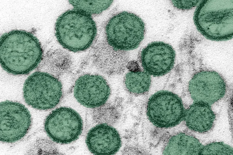 The Hidden Threat: How the Andes Hantavirus Cruise Ship Outbreak Exposed Global Health Vulnerabilities