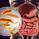 The Protein Shield: How Dietary Shifts Could Become a New Frontier in Fighting Cholera