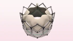 A Decade of Discovery: How 10-Year Data Redefines the Evolution of TAVR