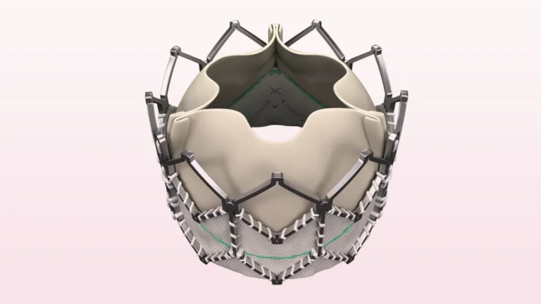 A Decade of Discovery: How 10-Year Data Redefines the Evolution of TAVR