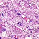 A New Frontier in Gene Editing: Serapha Bio Emerges with $230 Million and a Strategic Reverse Merger