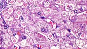 A New Frontier in Gene Editing: Serapha Bio Emerges with $230 Million and a Strategic Reverse Merger