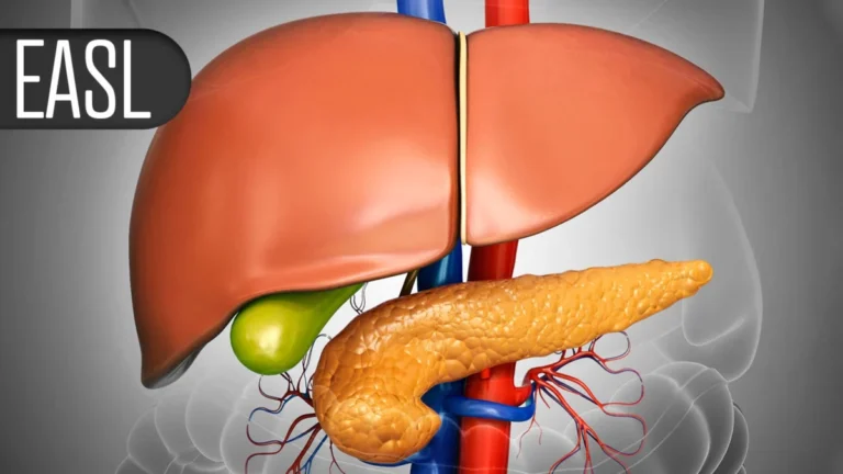 Breakthrough in Primary Biliary Cholangitis: Saroglitazar Shows Promise in Landmark EPICS-III Trial
