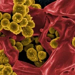 Cefazolin Emerges as Gold Standard for MSSA Bacteremia: Landmark SNAP Trial Results