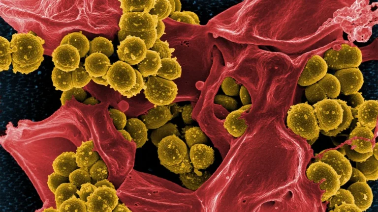 Cefazolin Emerges as Gold Standard for MSSA Bacteremia: Landmark SNAP Trial Results