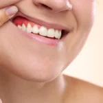 Fasting for a Healthier Smile: How Caloric Restriction Could Combat Gum Disease