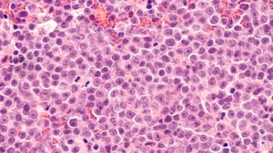 Legend Biotech’s “In Vivo” Breakthrough: A New Frontier in CAR-T Therapy