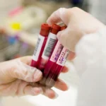 Navigating the Shift: The Debate Over Blood-Based Colorectal Cancer Screening Guidelines