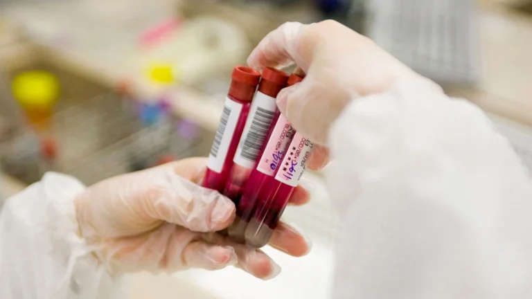 Navigating the Shift: The Debate Over Blood-Based Colorectal Cancer Screening Guidelines
