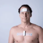 Streamlining Sleep Diagnostics: Onera Health and Somnoware Announce Strategic Integration