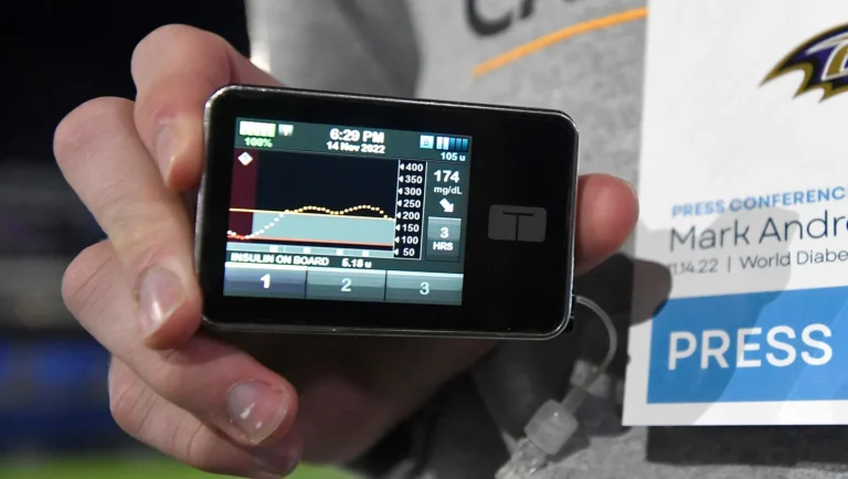 The Dawn of "Fully Closed Loop" Insulin Delivery: Redefining Diabetes Management