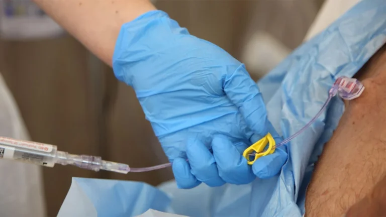 The Immunotherapy Revolution in Esophageal Cancer: A New Era of Perioperative Care