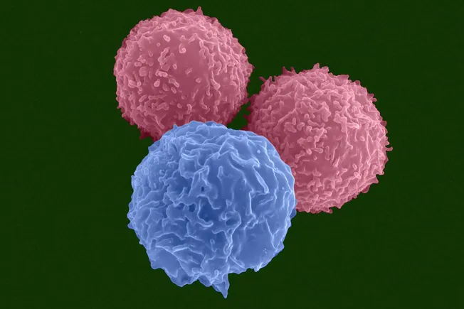 The Next Frontier in Oncology: Jazz Pharmaceuticals and AbCellera Forge Alliance to Advance Multispecific T-Cell Engagers