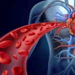 The Silent Threat: How the "Double Burden" of Sleep Disturbance Fuels Hypertension