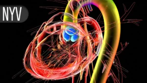 The TAVR Paradox: Bridging the Divide Between Clinical Trials and Real-World Outcomes