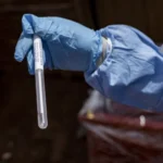 U.S. Deploys Experimental Ebola Treatment Amid Diplomatic and Logistical Tensions