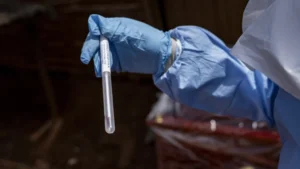 U.S. Deploys Experimental Ebola Treatment Amid Diplomatic and Logistical Tensions