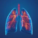 Unlocking the Invisible: New Research Reveals Hidden Systemic Inflammation in Primary Ciliary Dyskinesia