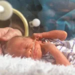 A New Frontier in Fetal Medicine: Serial Amnioinfusions Offer Hope Amidst Complex Ethical Challenges