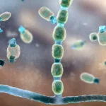 A New Frontier in Fighting "Valley Fever": Olorofim Offers Hope for Intractable Disseminated Coccidioidomycosis