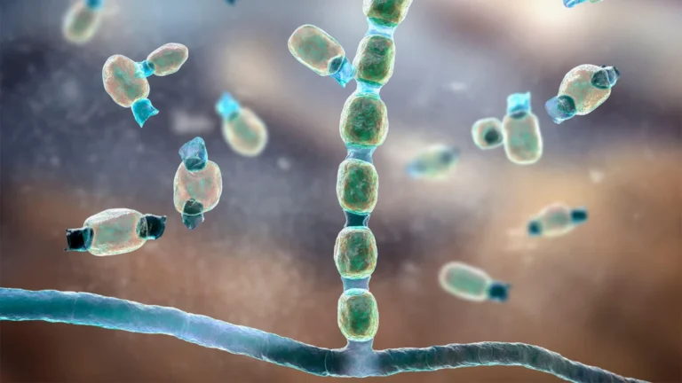 A New Frontier in Fighting "Valley Fever": Olorofim Offers Hope for Intractable Disseminated Coccidioidomycosis