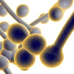 A New Frontier in Mycology: Olorofim Offers Hope for Refractory Valley Fever