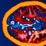 A Potential Shift in Multiple Sclerosis Care: The OVERLORD-MS Trial Challenges Cost Paradigms