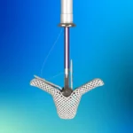 Abbott Doubles Down on TriClip: A Strategic Pivot in the Competitive Transcatheter Valve Market