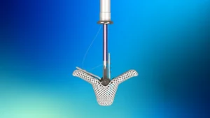 Abbott Doubles Down on TriClip: A Strategic Pivot in the Competitive Transcatheter Valve Market