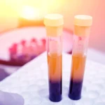 Advancing Precision Diagnostics: Zepto Life Technology Expands FungiFlex Portfolio to Combat Invasive Fungal Infections