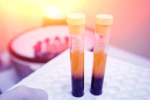 Advancing Precision Diagnostics: Zepto Life Technology Expands FungiFlex Portfolio to Combat Invasive Fungal Infections
