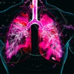 AstraZeneca Challenges Merck in COPD Arena with $200 Million Sino Biopharm Deal