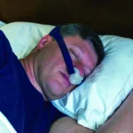 Beyond CPAP: A Comprehensive Guide to Expiratory Positive Airway Pressure (EPAP) Therapy