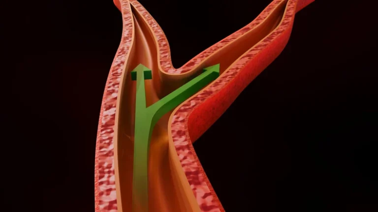 Breakthrough in Neurocritical Care: FDA Grants Designation to Aurenar’s V-Link System for Cerebral Vasospasm